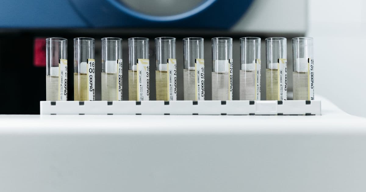 Do Peptides Show Up on a Drug Test?
