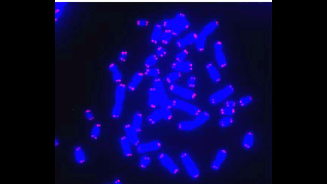 Human chromosomes (blue) with telomeres glowing pink at each tip, visualized under fluorescence microscopy. These protective caps shorten with every cell division until the cell dies. Epitalon reactivates the enzyme that rebuilds them.