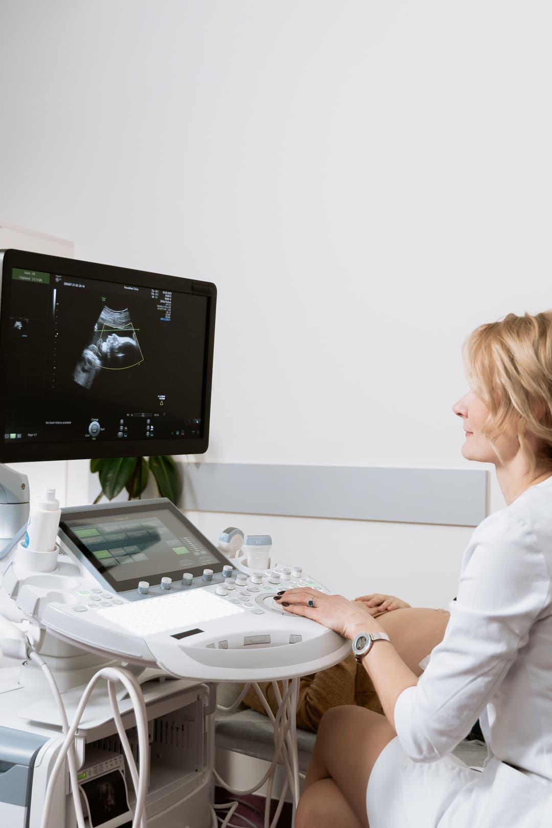 Sustained arm abduction and transducer pressure make the scanning shoulder the leading work-related injury in sonography, and peptide therapy targets the connective-tissue side of it.
