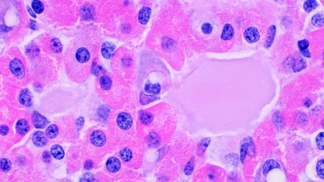 Anterior pituitary cells under H&E stain. The large pink eosinophilic cells are somatotrophs, the growth hormone factories that both Tesamorelin and Ipamorelin activate through independent receptor pathways.
