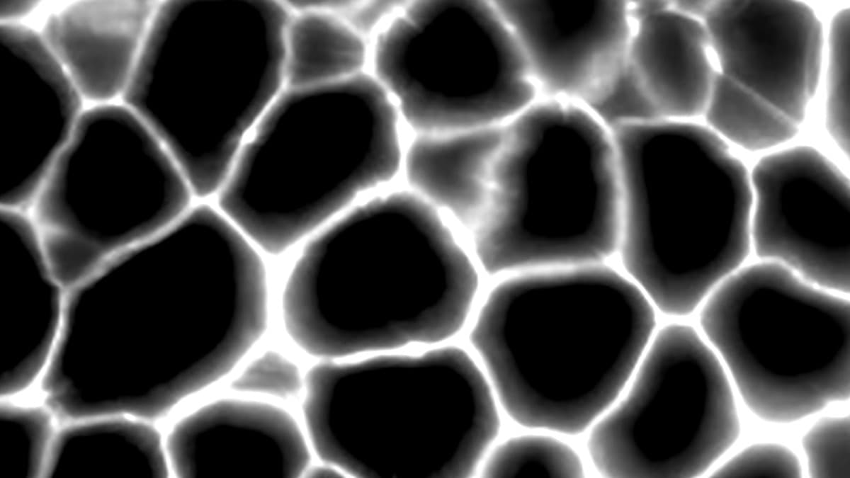 White adipose tissue under light sheet fluorescence microscopy. Each dark void is a single fat cell packed with stored lipid. AOD-9604 targets these cells through beta-3 adrenergic receptors to trigger lipolysis.