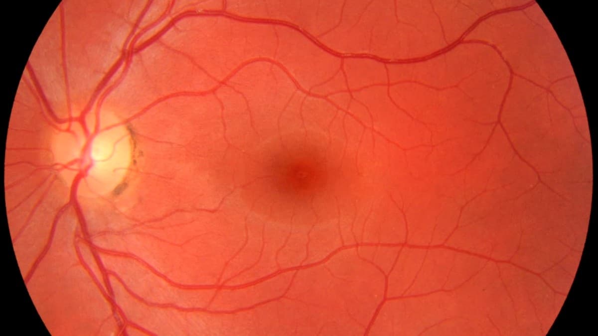 Retinal fundus photograph showing the branching vascular network of a healthy human eye. BPC-157 triggers VEGF signaling for new blood vessels. TB-500 migrates the endothelial cells to build them.
