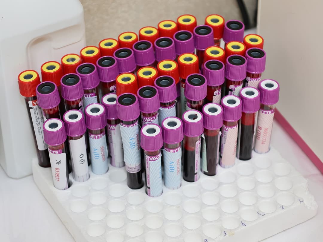 The honest answer to "what bloodwork do I need before peptides?" is: it depends on the peptide, and for many of them the answer is none.