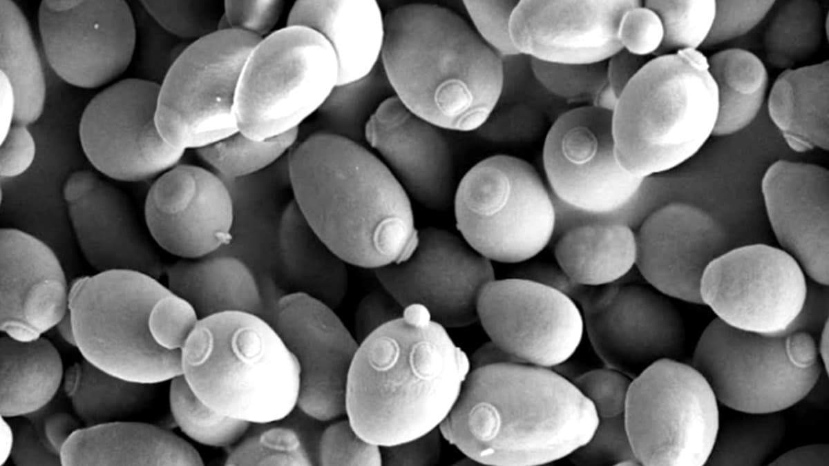 Saccharomyces cerevisiae (brewer's yeast) under scanning electron microscopy. In 1906, Arthur Harden and William Young discovered NAD+ while studying how these cells ferment sugar. That work contributed to a Nobel Prize. The molecule they found is now Hollywood's most expensive anti-aging treatment.