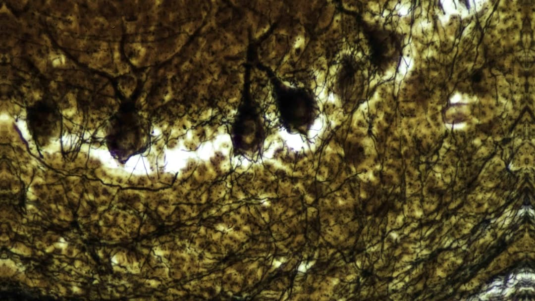 Silver-stained Purkinje neurons in the cerebellum, among the brain's most elaborately branched cells. This is the kind of neural architecture that a neuroprotective blend is designed to preserve.