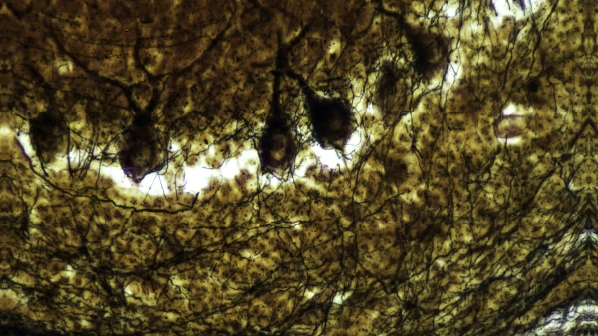 Pinealon/PE-22-28/Selank neuroprotective research