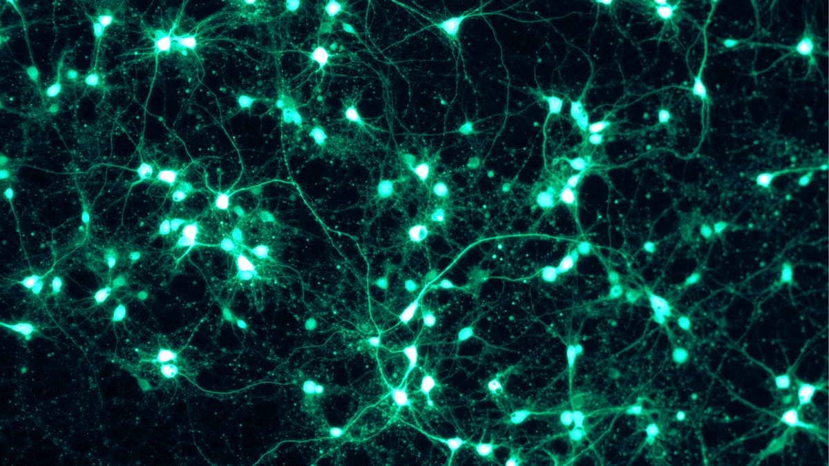 Neurons expressing green fluorescent protein (GFP), their branching dendrites and axons glowing under fluorescence microscopy. Semax upregulates BDNF, the protein that drives this kind of neural growth and connectivity. Selank modulates the GABA signaling that flows through these networks.