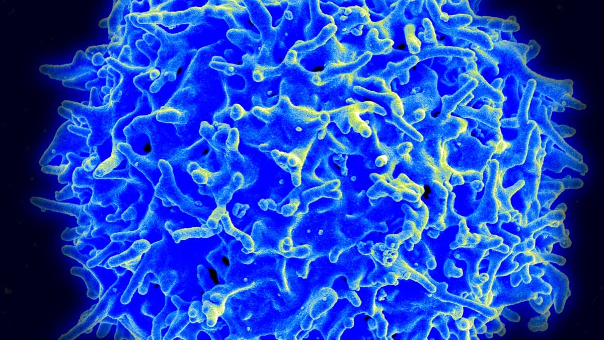 A healthy human T-cell under scanning electron microscopy. The surface projections (microvilli) help T-cells detect threats and communicate with other immune cells. Your thymus gland trains every T-cell you have, but it starts disappearing after puberty. Thymosin Alpha-1 is the hormone it used to make.